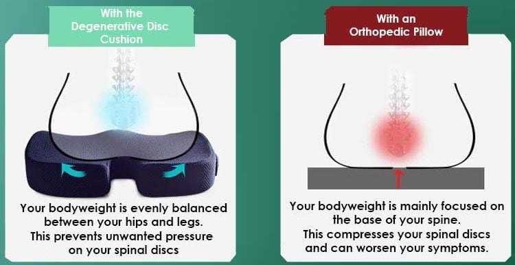 Clevive Degenerative Disc Disease Cushion Clevive