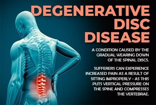 Clevive™ Degenerative Disc Disease Cushion